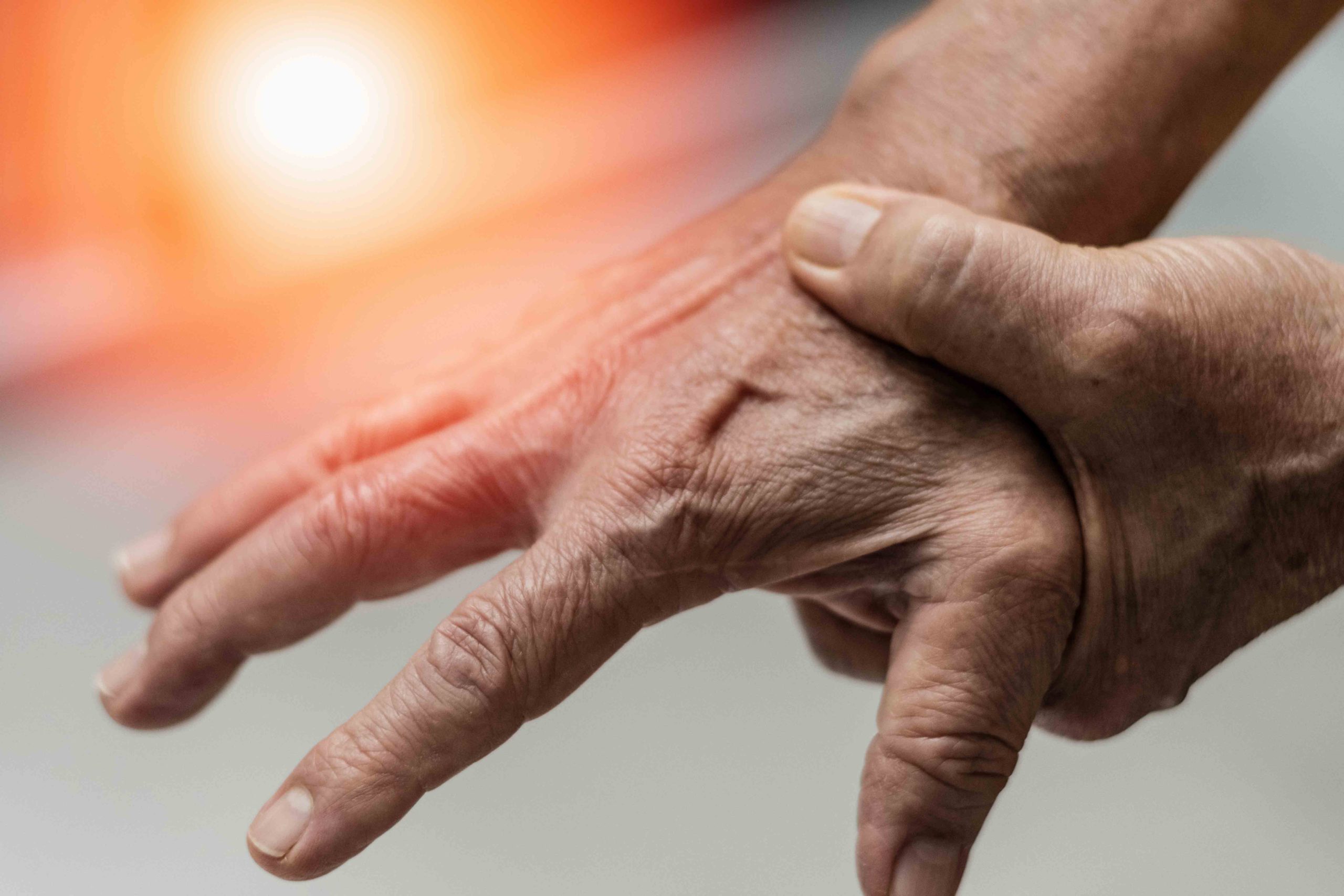 early signs and symptoms of arthritis