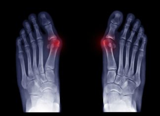 Five Reasons Your Big Toe Might Hurt