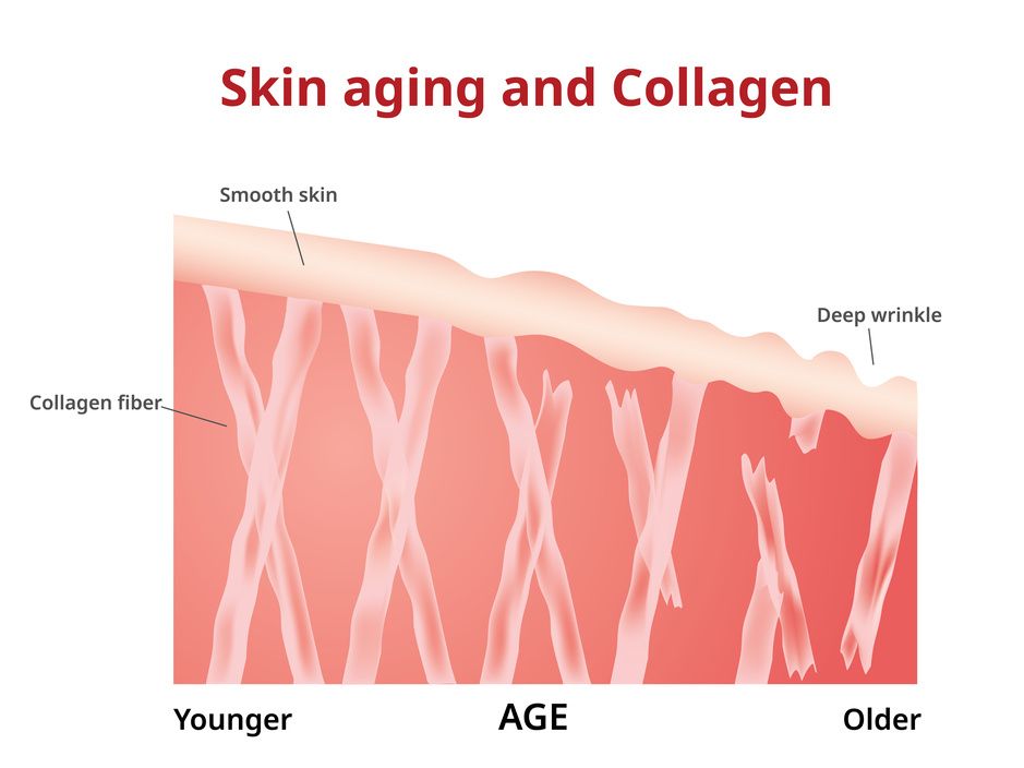 Why Women Need to Consume Collagen